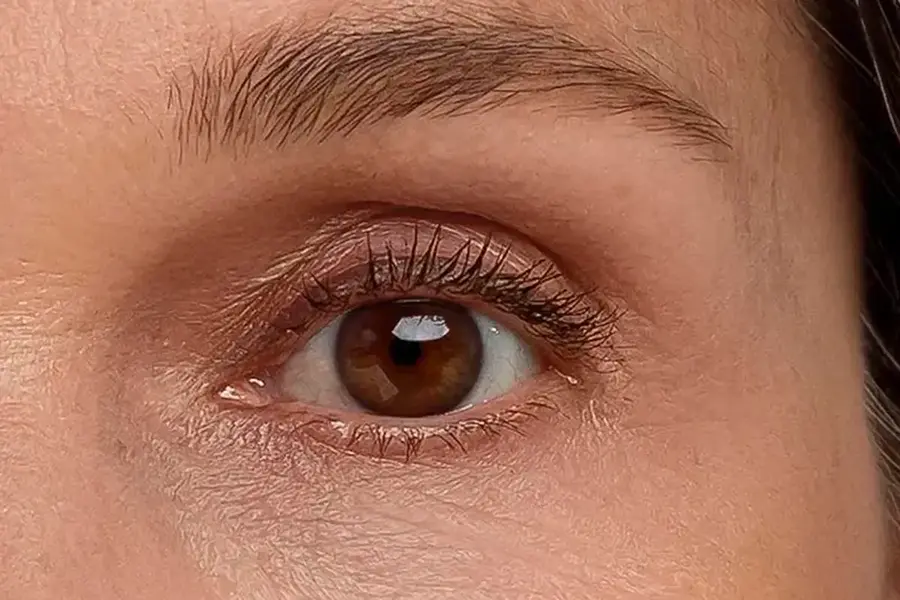 Augenpartie nach regelmäßiger Anwendung der orangeblue Anti-Aging Augencreme – glattere, straffere Haut
